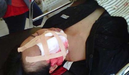 Wartawan Ditembak Polisi, Timur Pradopo Sesali Tanpa Minta Maaf